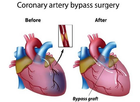 Heart Specialist in Ahmedabad