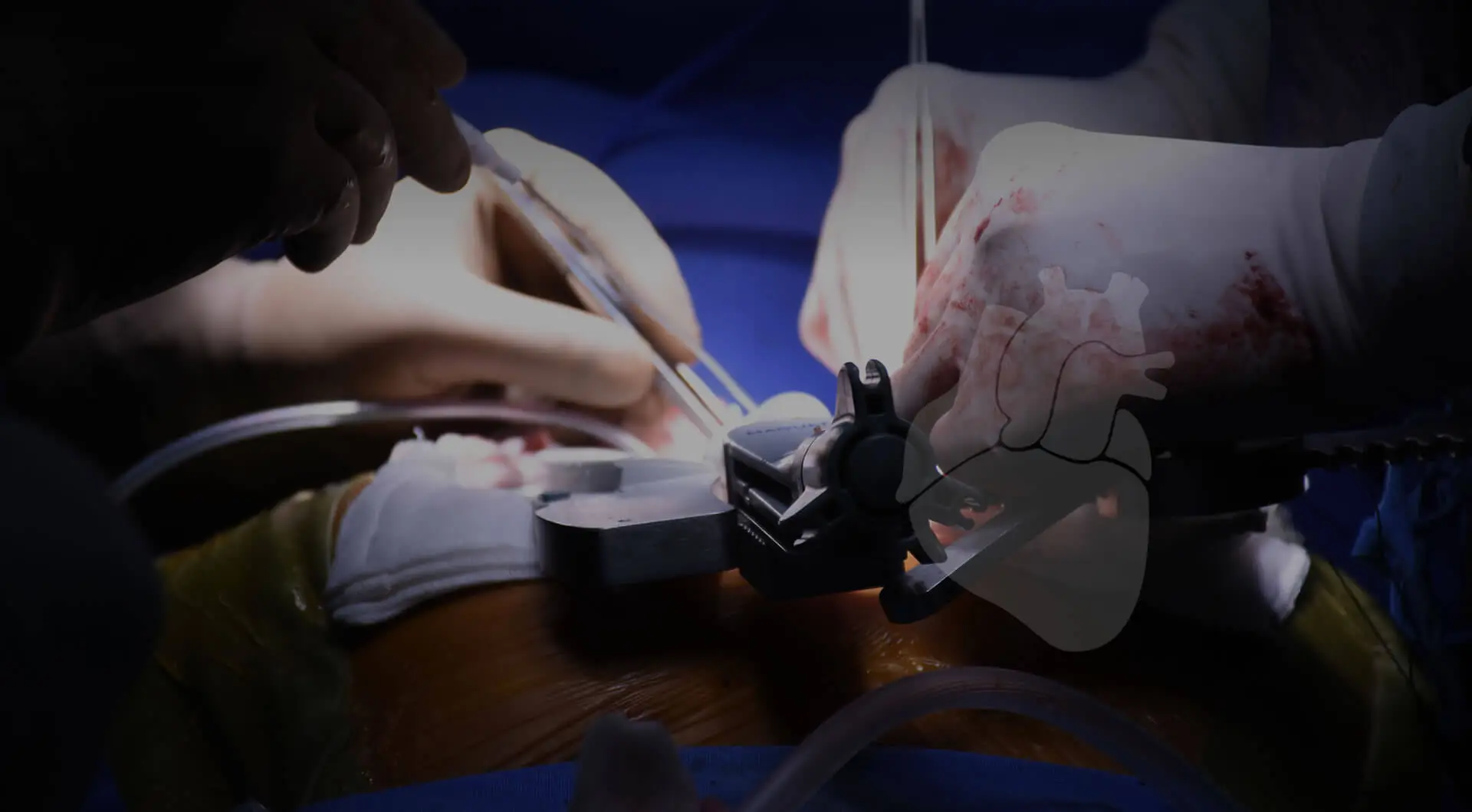 Best Cardiac Surgeon